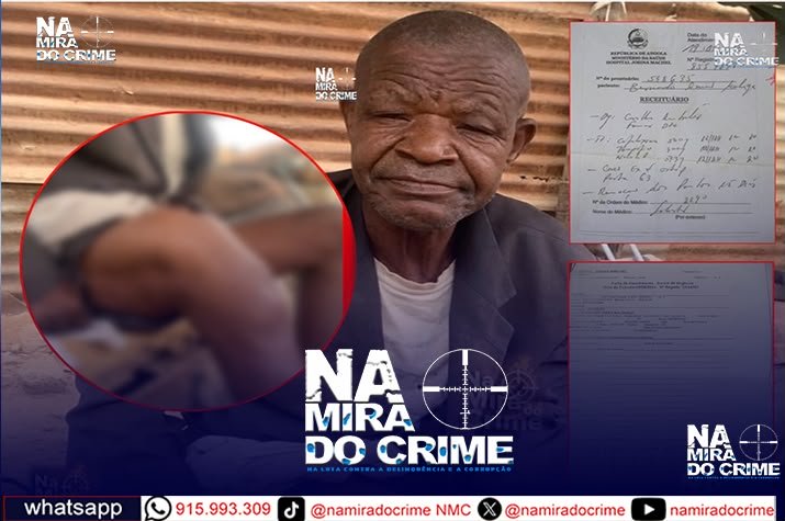 Foi operado no Maria Pia - Idoso de 69 anos vive há 14 anos com fragmento de ferro alojado na perna e pede intervenção médica