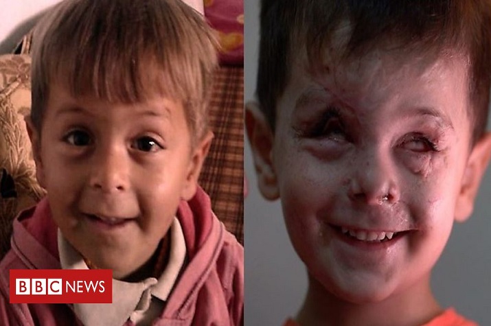 O rosto da criança que traduz a tragédia e o horror da guerra na Síria